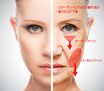 たるみ治療の相談なら大阪の医療法人秀晄会 コムロ美容外科へ
