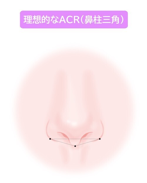 理想的なACR