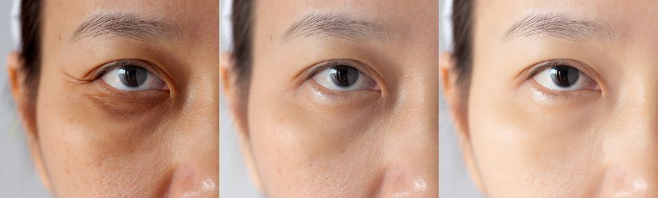 三白眼トップ