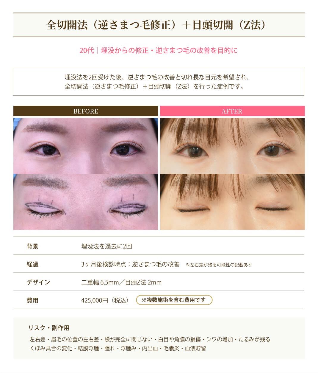 症例1