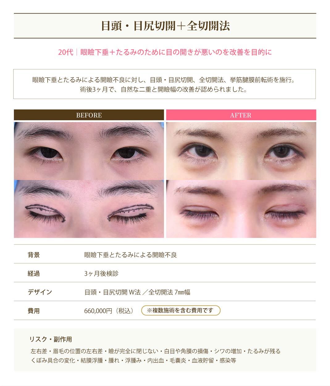 症例2