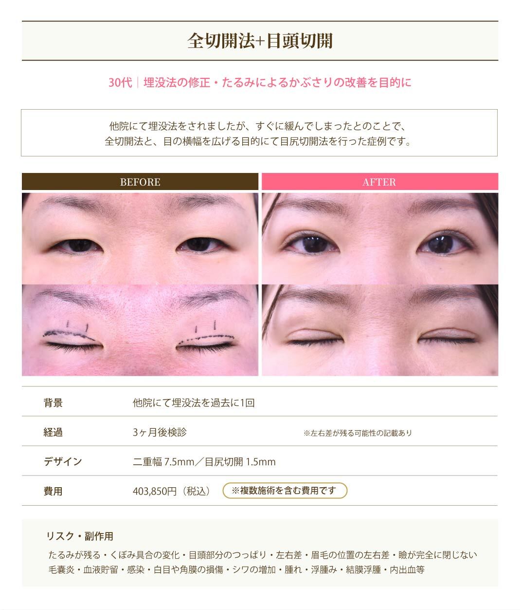 症例3