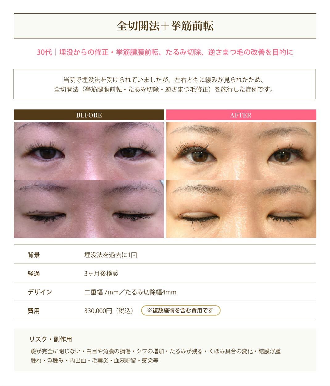 症例4
