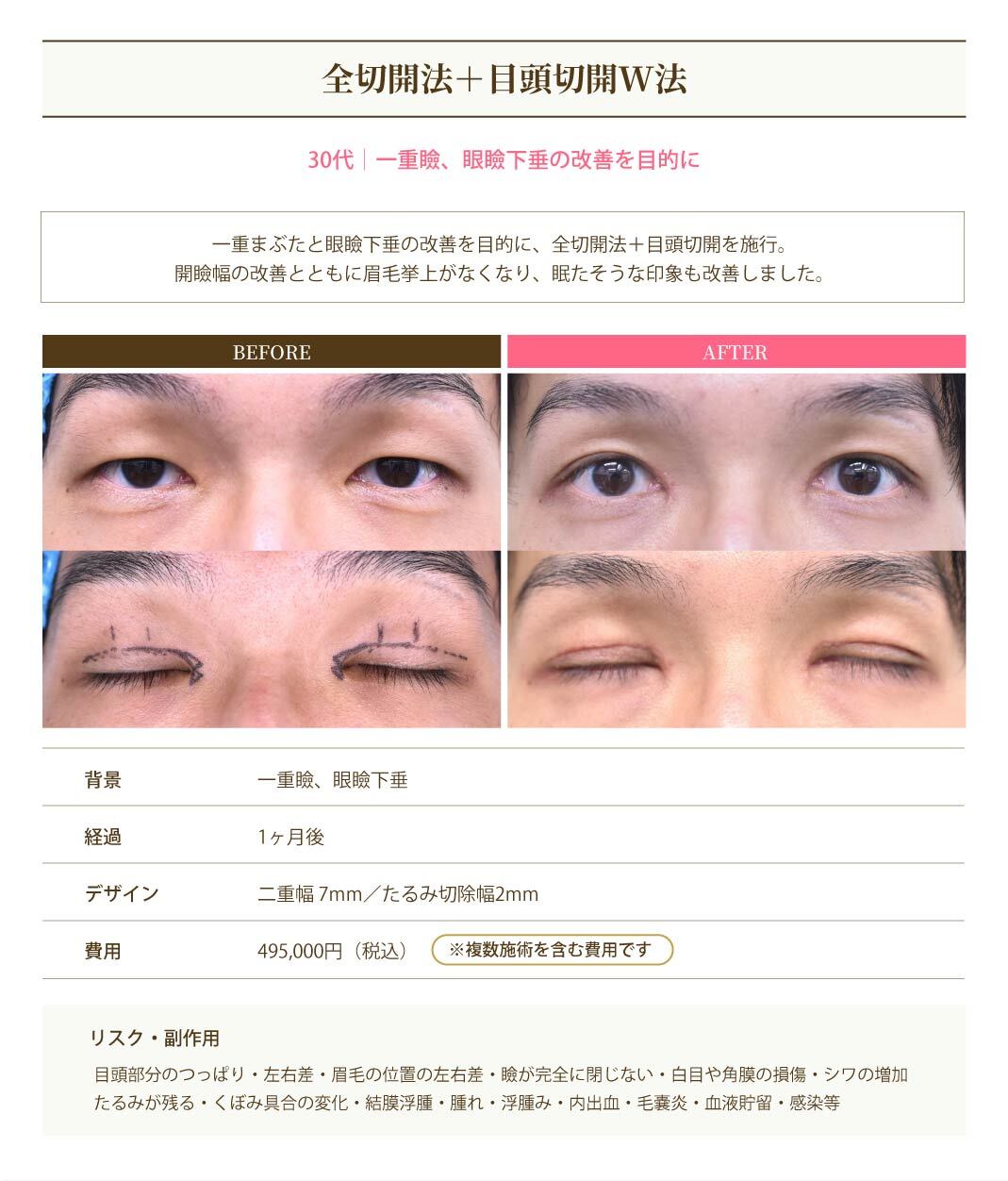 症例5