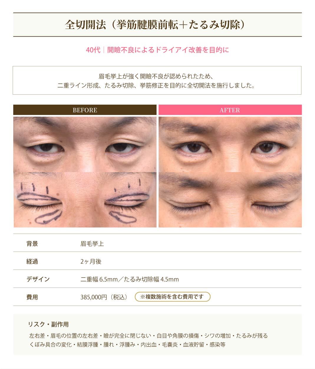 症例6