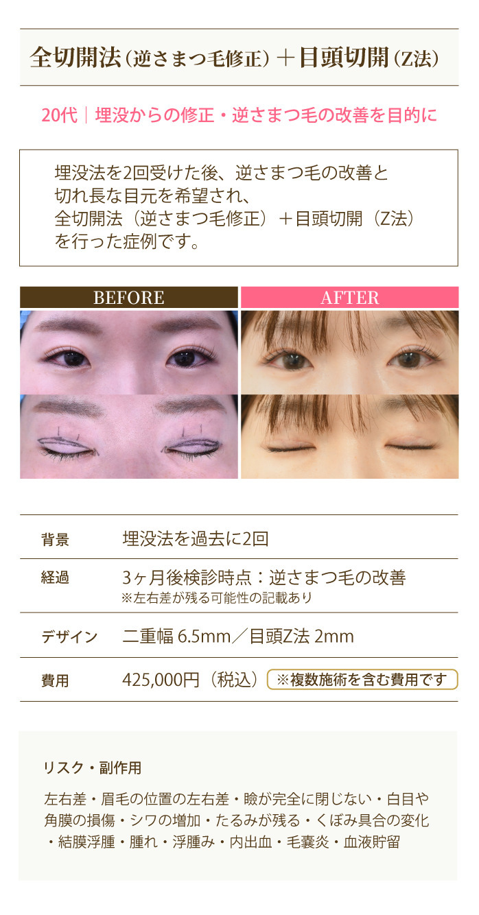 症例1