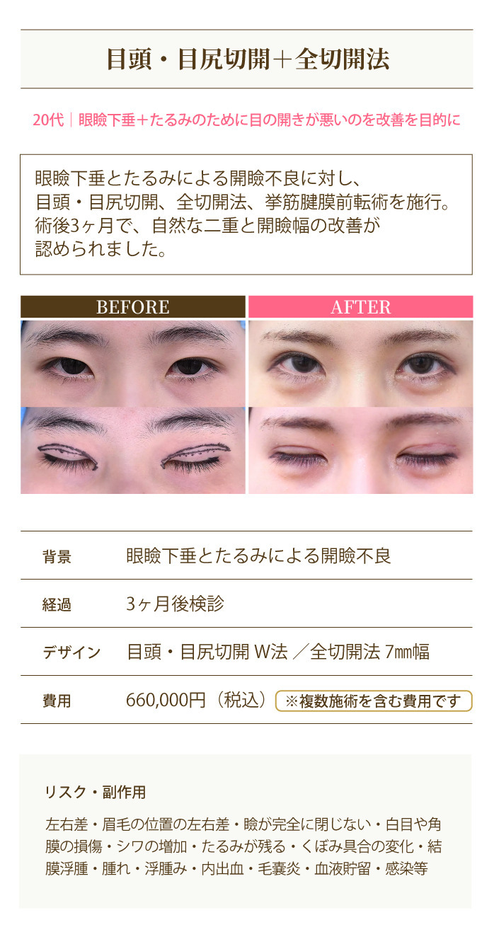 症例2