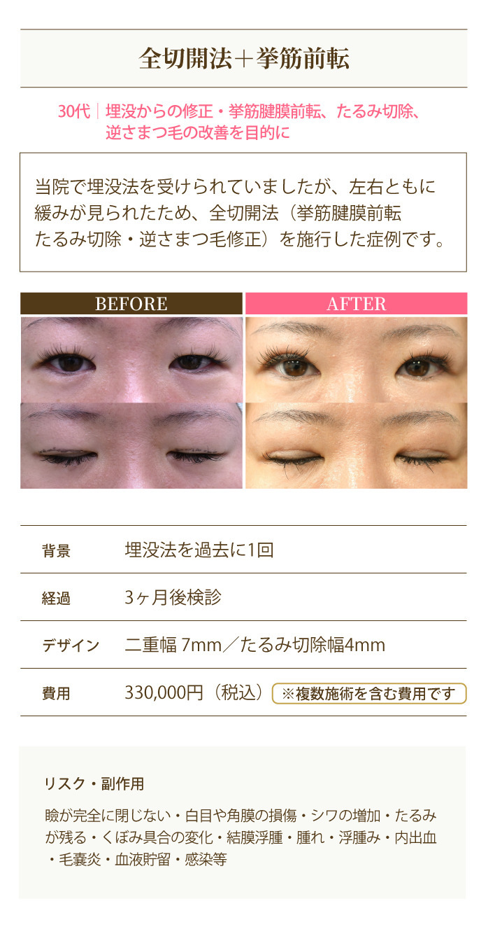 症例4