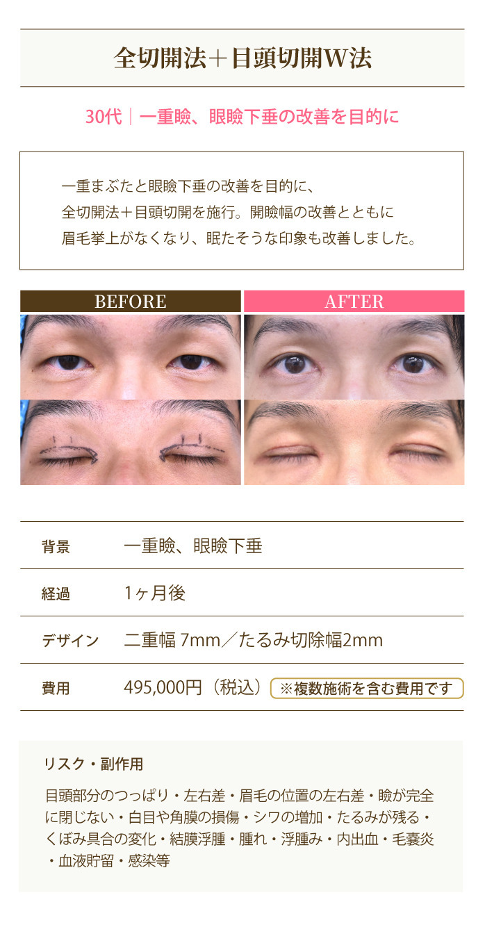 症例5