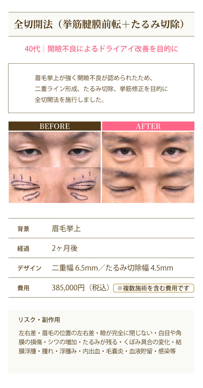 症例6