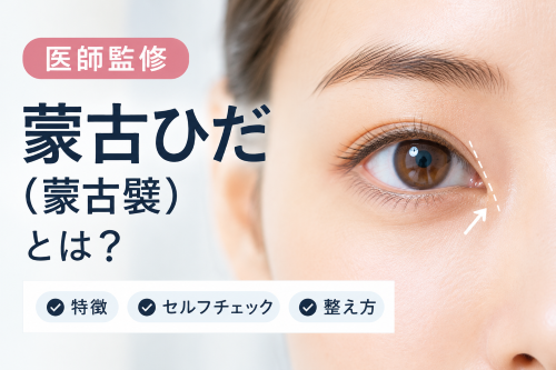 蒙古ひだとは