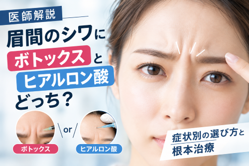 眉間のしわ　ヒアルロン酸とボトックスどっち
