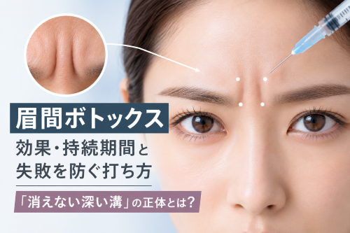 眉間ボトックスと深いシワの原因