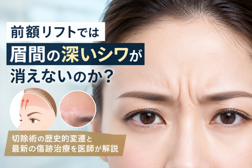 なぜ前額リフトでは眉間の深いシワが消えないのか？