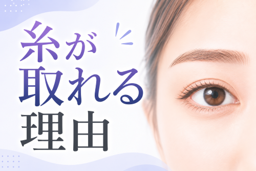 糸が取れる理由