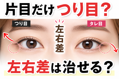 タレ目形成で片目だけのツリ目は直せる？