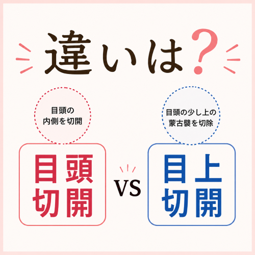 目頭切開と目上切開の違い