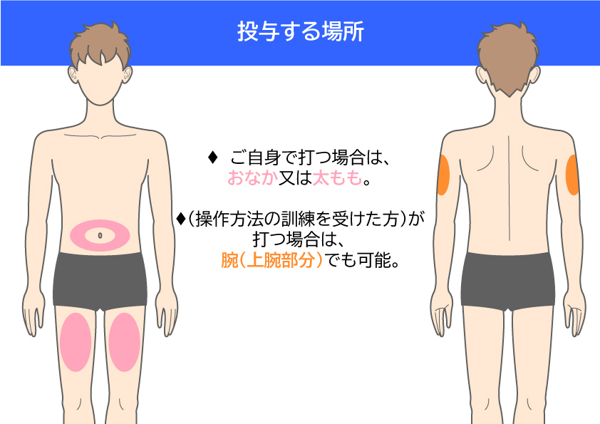 マンジャロ使い方5