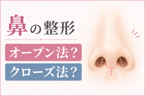 鼻の整形オープン法クローズ法違い