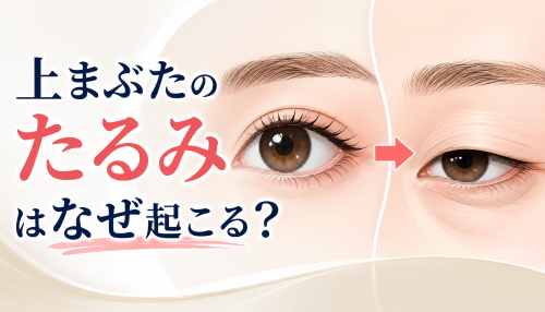 上まぶたのたるみ