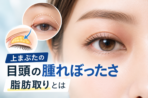 目頭の腫れぼったさイメージ