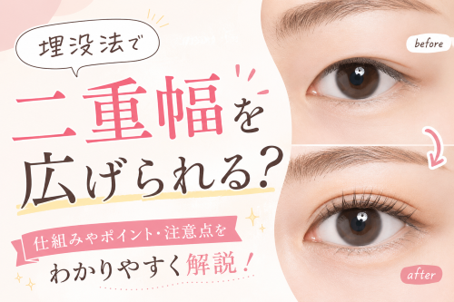 埋没法で二重幅を広げられる？