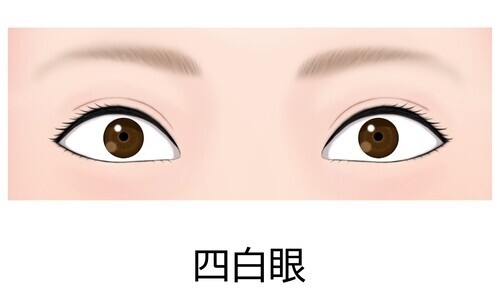 四白眼