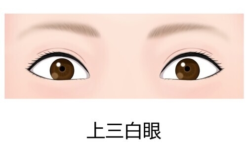 上三白眼