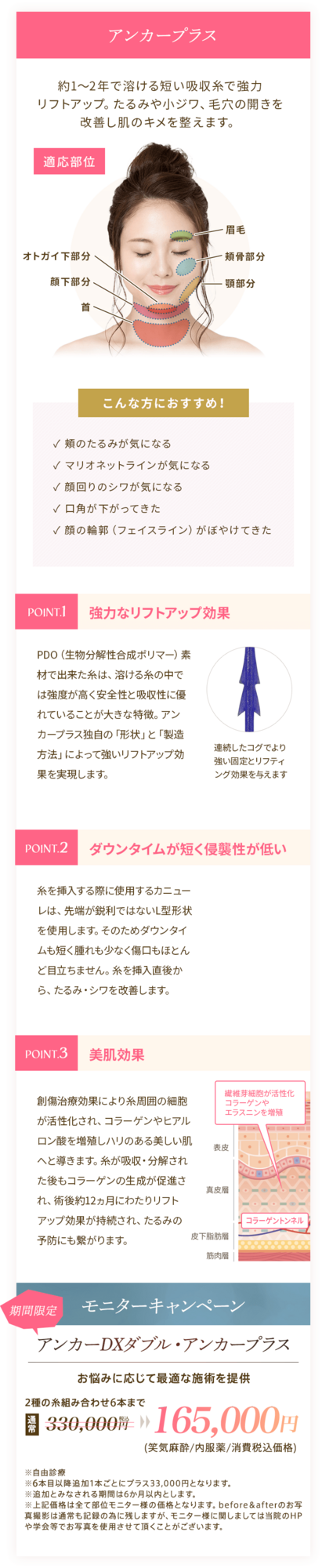 アンカープラス